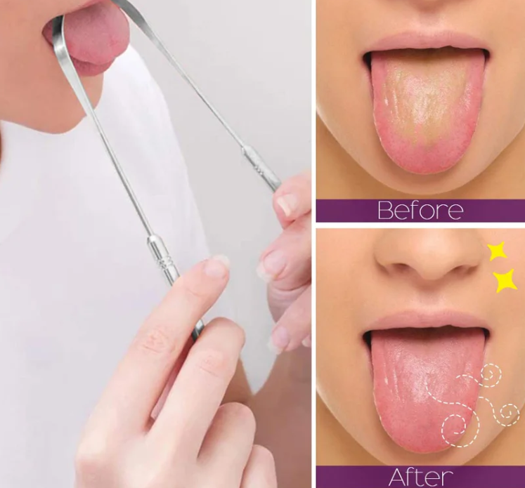 Tongue Scraper